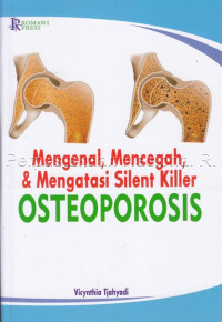 Image of Mengenal, Mencegah, dan Mengatasi Silent Killer Osteoporosis
